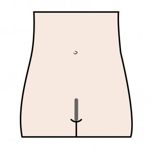 Brazilian Wax Diagram